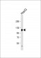GLDC Antibody (N-term)